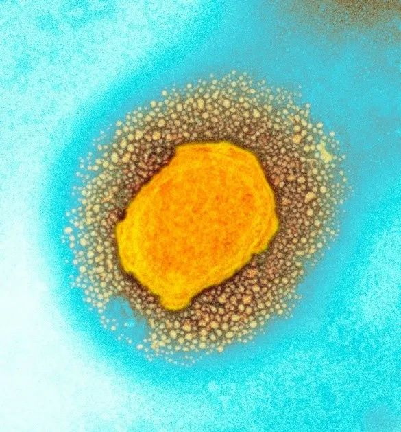 猴痘病毒（彩色透射电子显微照片）